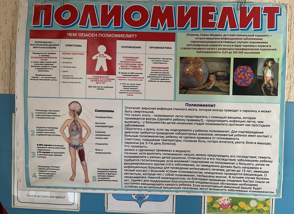 ПОЛИОМИЕЛИТ