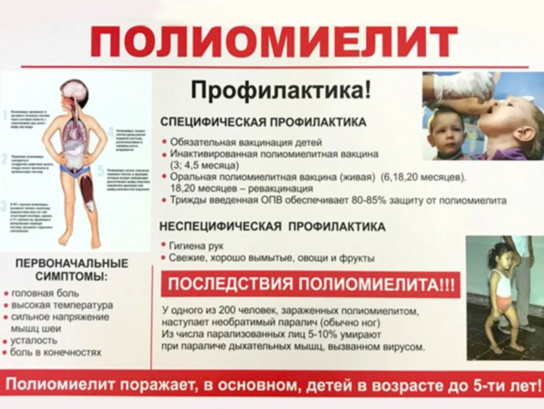 Полиомиелит. Полиомиелит.