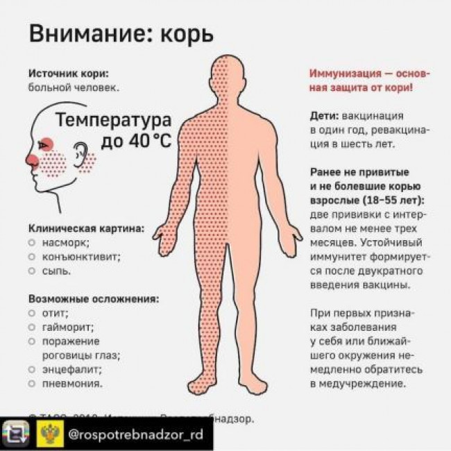 ВНИМАНИЕ КОРЬ!