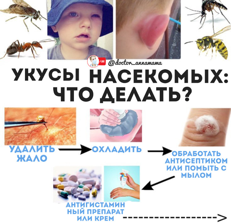 Как защитить ребёнка от укусов?